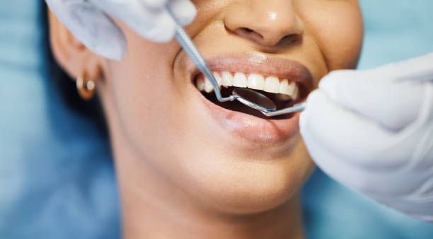 Best Emergency Treatment for Oral Infections in China, TX